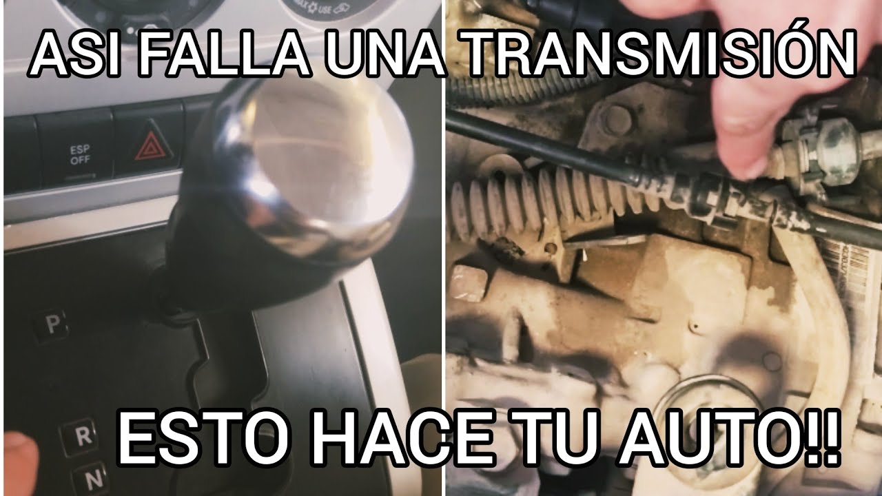 SINTOMAS de una 