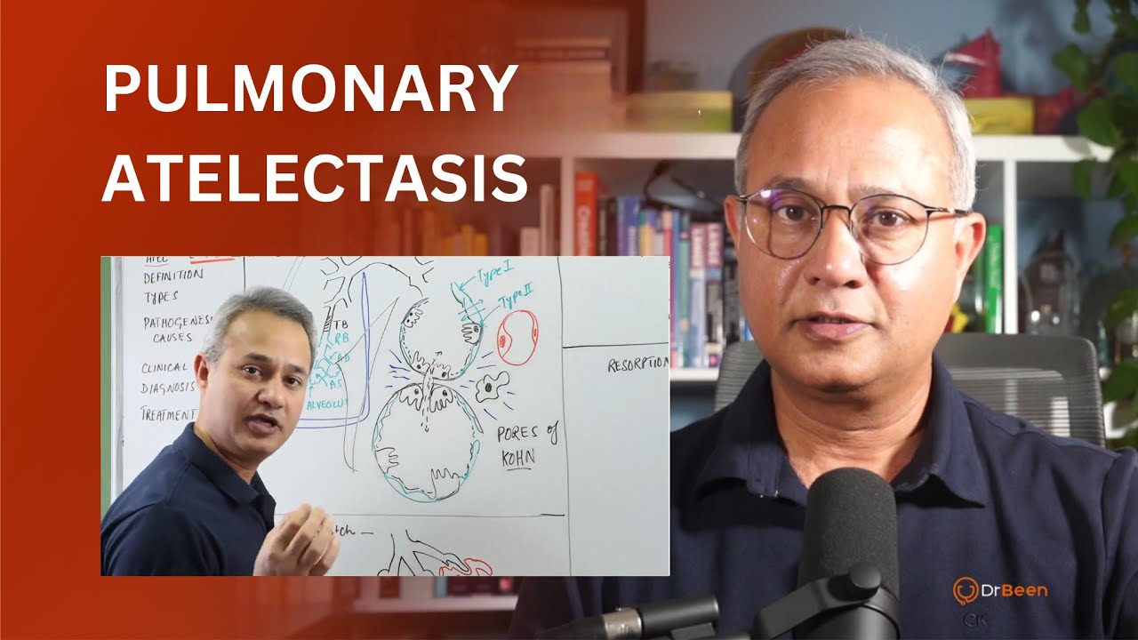Pulmonary Atelectasis