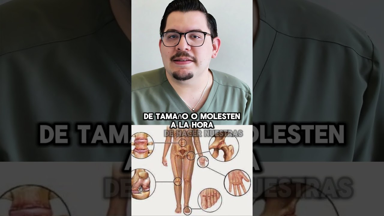 🧴 &iquest;Tienes psoriasis? No olvides revisar tus u&ntilde;as 💅