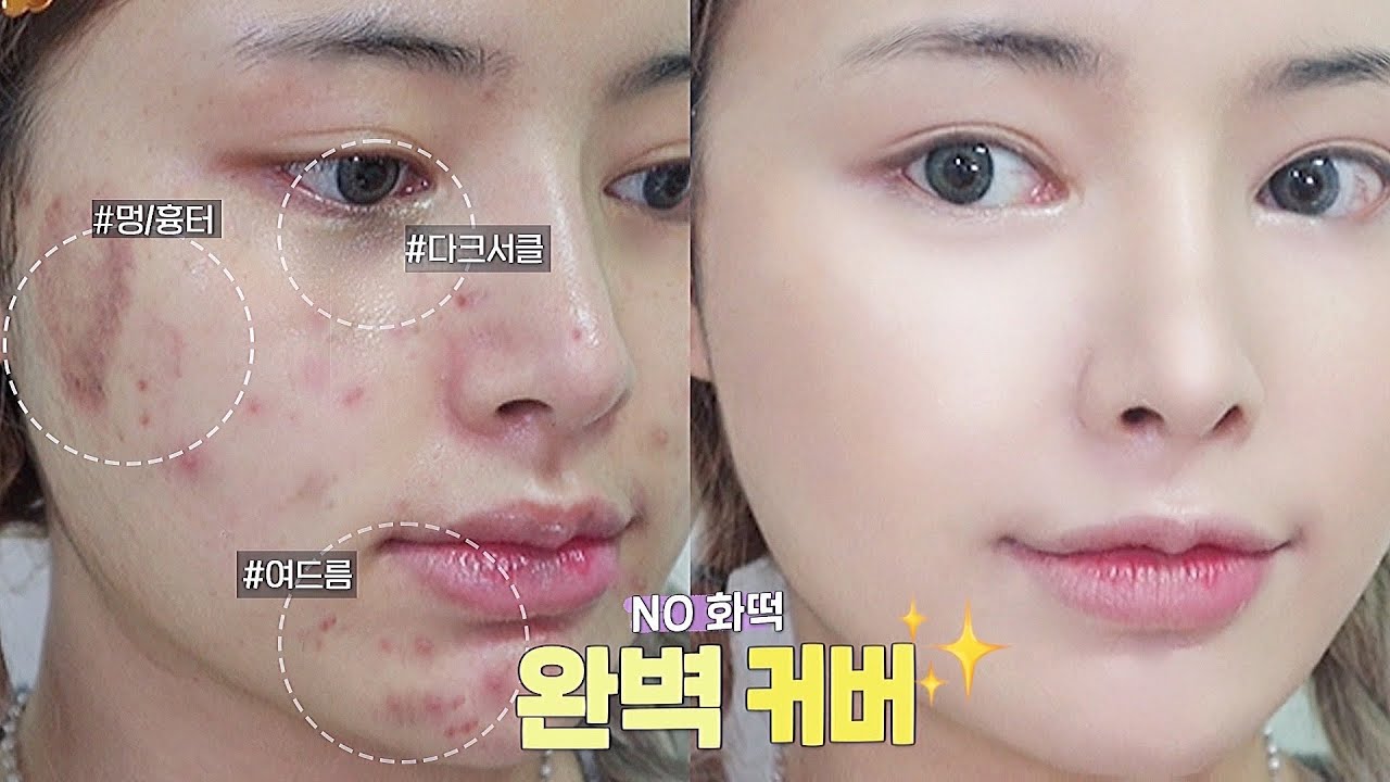 Eng/jpn)로드샵 제품들로 청담동st 커버 베이스🤫| 여드름/다크서클/멍,흉터 커버 비법 탈탈탈~