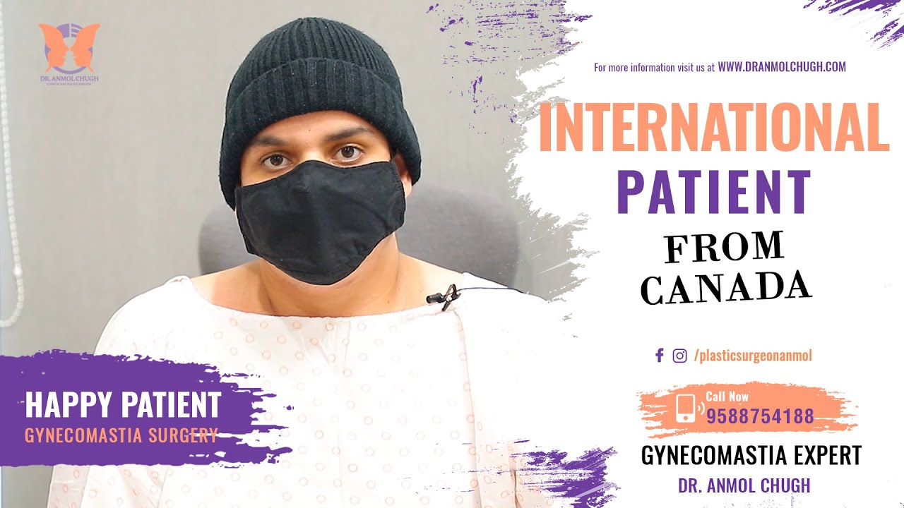 Gynecomastia Surgery Happy International Patient Testimonial from Canada | Man BOOBS Surgery India