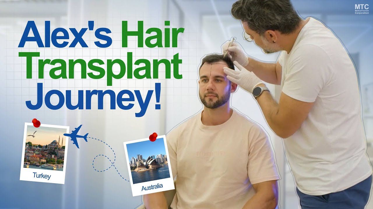 Hair Transplant in Istanbul Review: This Australian Visits Turkey for Hair Restoration!