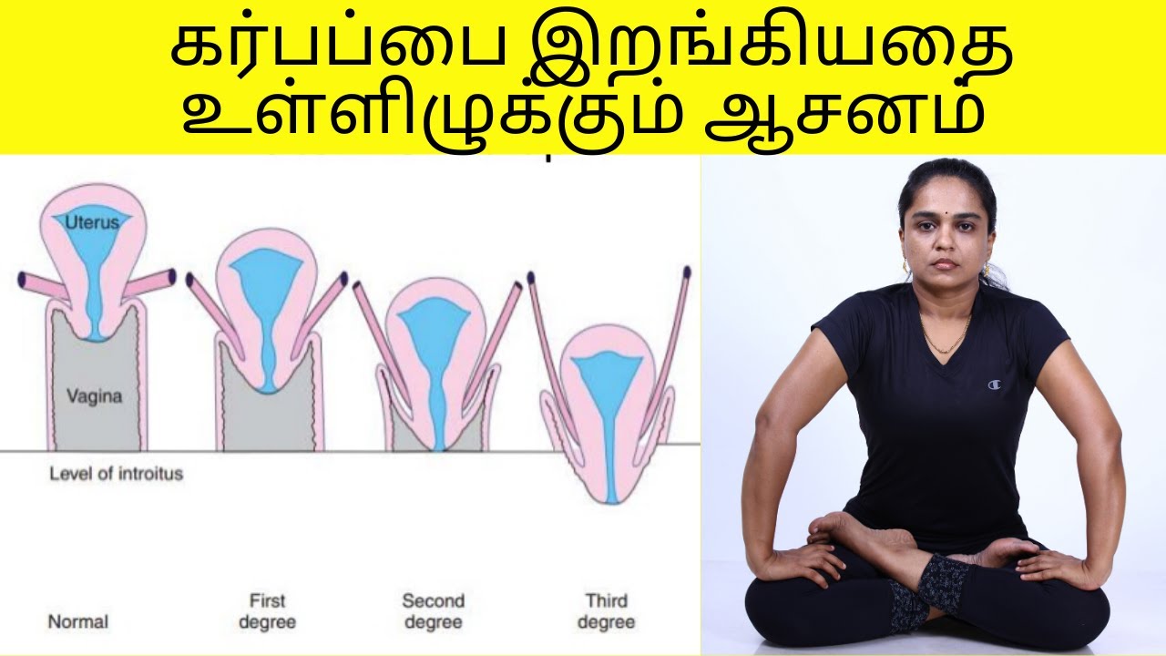 Cure for Uterus problem/Yoga For Uterus Prolapse/கர்பப்பை இறக்கத்திற்கான யோகா in Tamil By Dr.Lakshmi