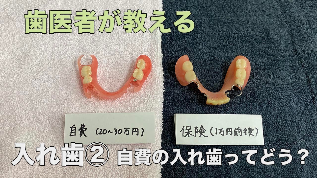 入れ歯② 自費の入れ歯について　当院ではこう考えます