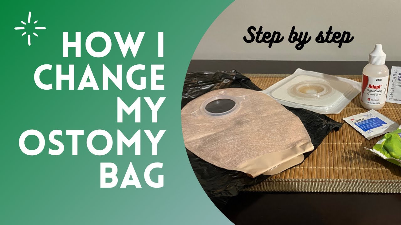Changing My #Ostomy Bag | #ConvaTec | Step by Step VISUAL