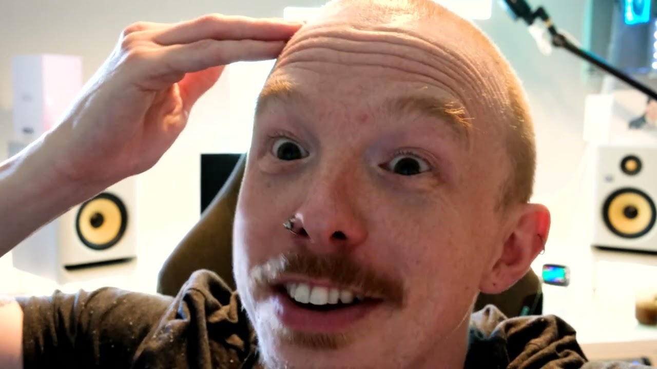 2 weeks after FUE hair transplant - no scabs, confidence boost