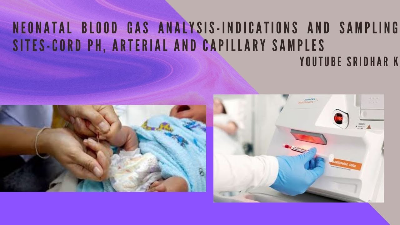 Blood gas analysis-indications and sampling sites cord pH, arterial, capillary samples. Dr Sridhar K