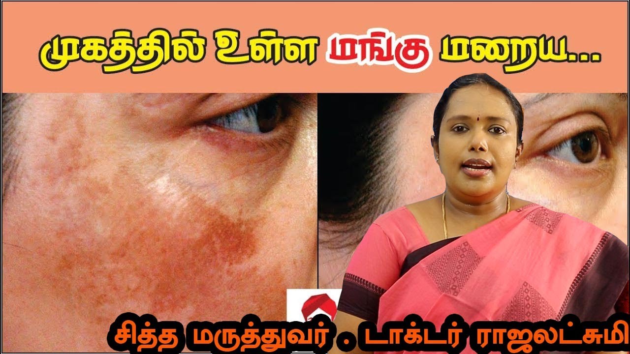 முகத்தில் ஏற்படும் மங்கு போவதற்கு என்ன செய்ய வேண்டும் | Dr.Rajalakshmi | ASM INFO