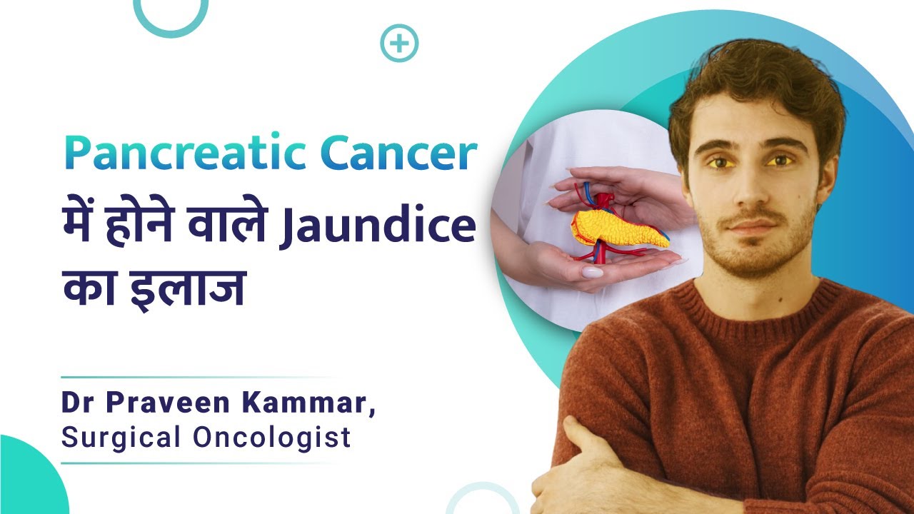 Treatment for pancreatic cancer-related jaundice | pancreatic cancer | Dr. Praveen Kammar