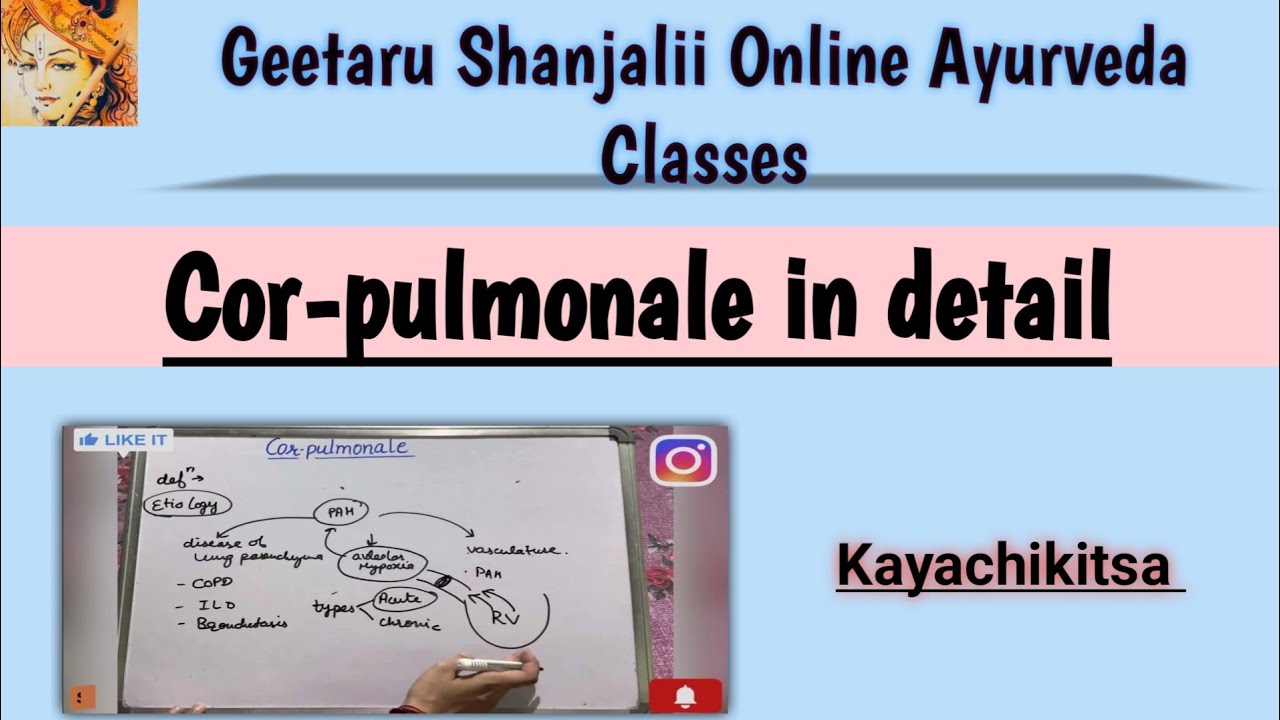 Cor-pulmonale in detail introduction definition etiology |PG SYLLABUS |Geetaru shanjalii Ayurveda