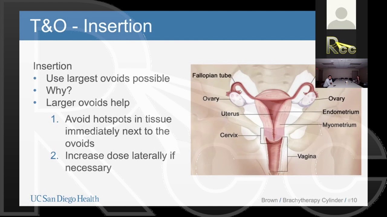 Rayos Contra Cancer HDR Brachytherapy Session 12: Tandem and Ovoid | Derek Brown