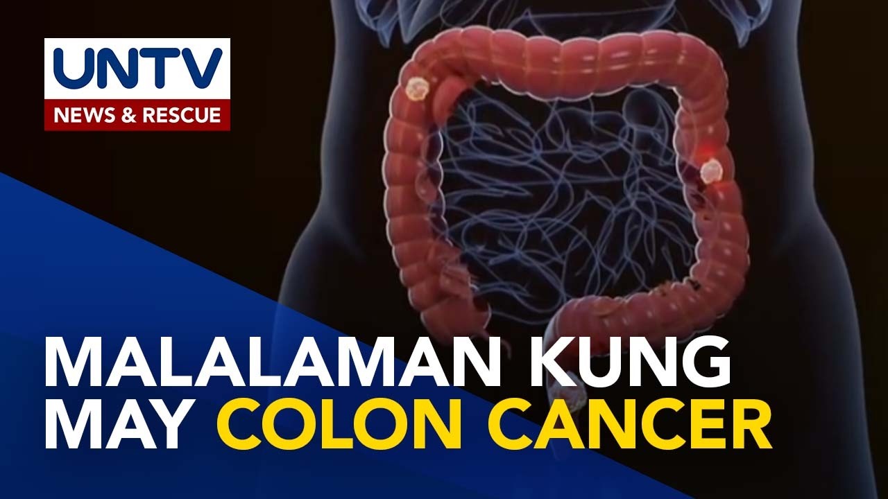 Ano ang fecal test for colon cancer at bakit ito mahalaga? | Now You Know