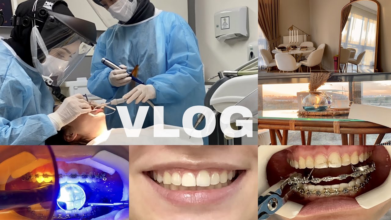 VLOG| DİŞ TELLERİ NASIL ÇIKAR? ANNA KARENİNA, MAVİ KELEBEK SARMAŞIĞI ÇAYI VE GÜN BATIMI PİTORESKİ