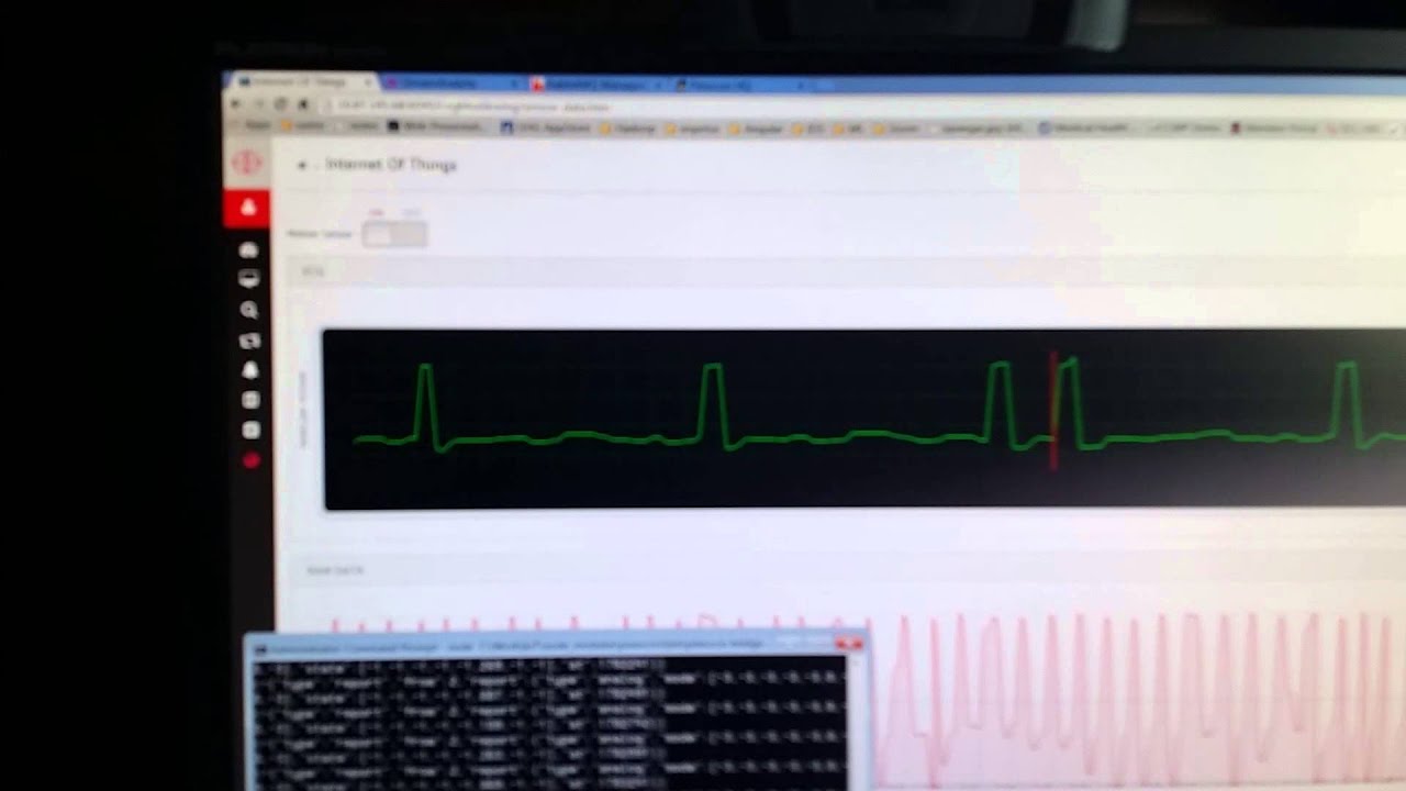 Pulse Sensor data streaming to Apache Storm via Pinoccio