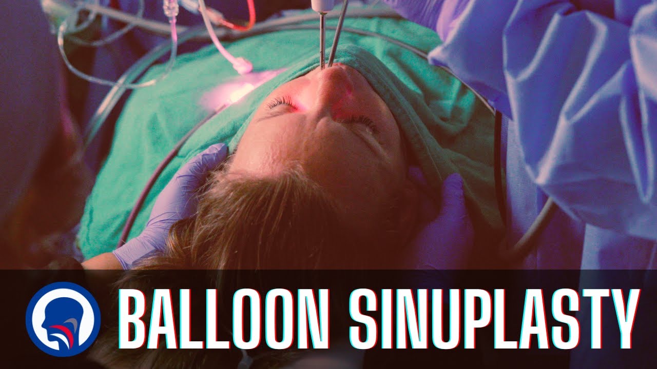 Процедура баллонной синусопластики | Capital ENT & Sinus Center