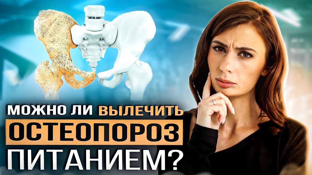 ЧТО ЕСТЬ при ОСТЕОПОРОЗЕ? Как вылечить остеопороз питанием и возможно ли ЭТО?