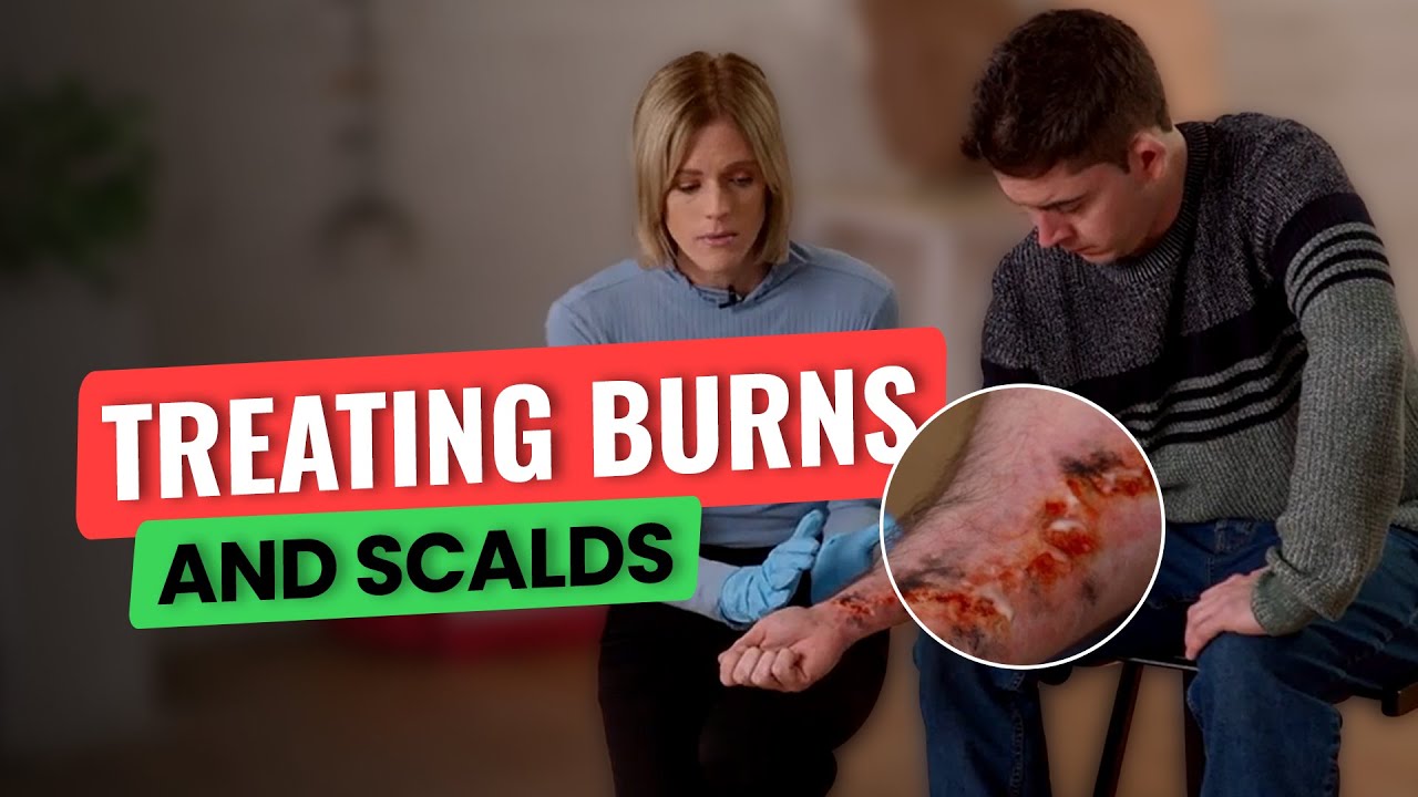 How to Treat Burns and Scalds | Essential First Aid Tips
