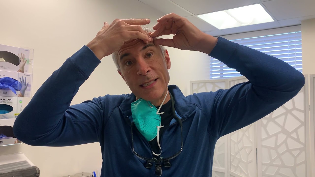 Designing hairline lowering surgery with Dr. Epstein