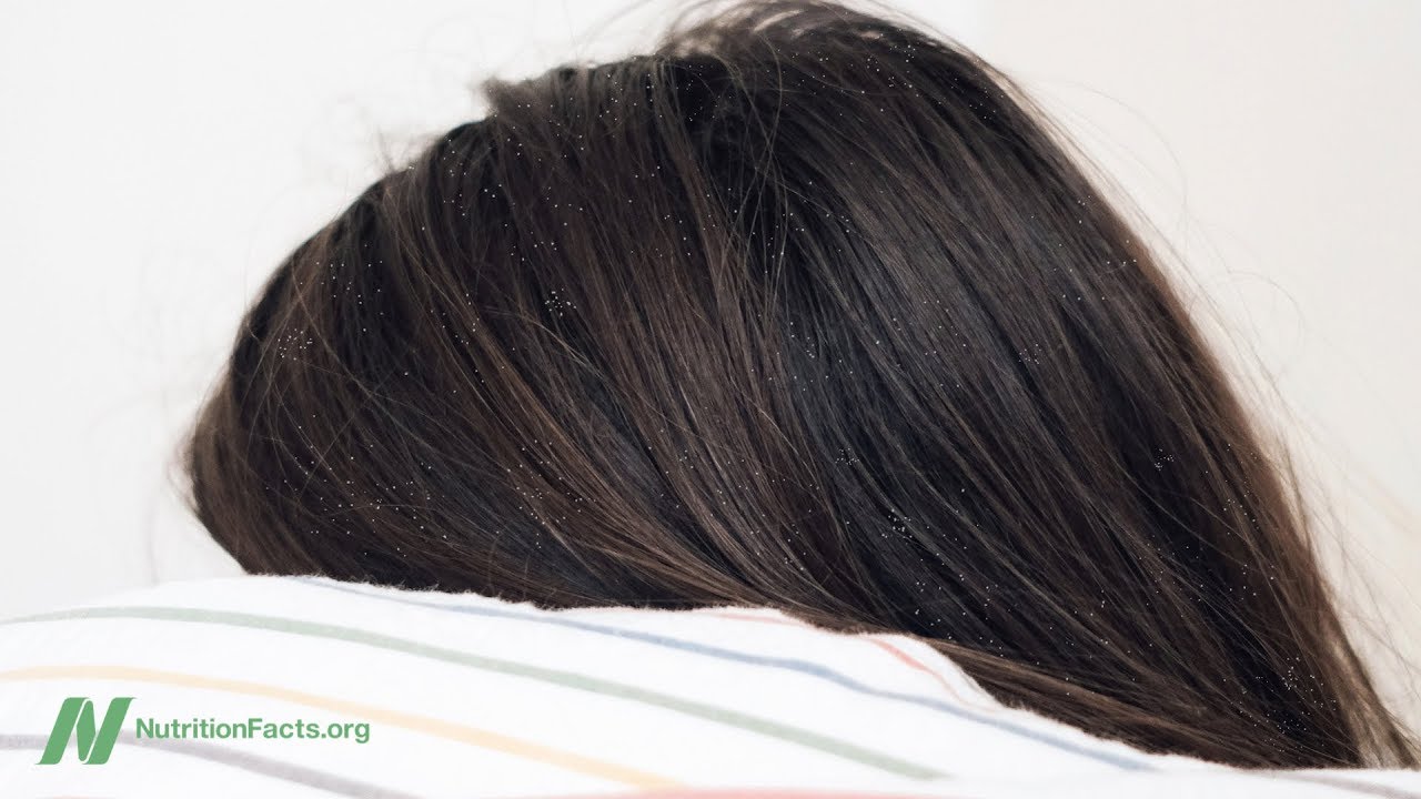 Does Tea Tree Oil Work for Dandruff and Athletes foot?