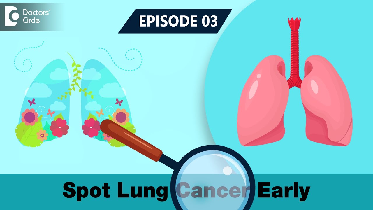 EARLY WARNING SIGNS of Lung Cancer | Spot Lung Cancer Early | Lung Cancer Screening- Doctors' Circle