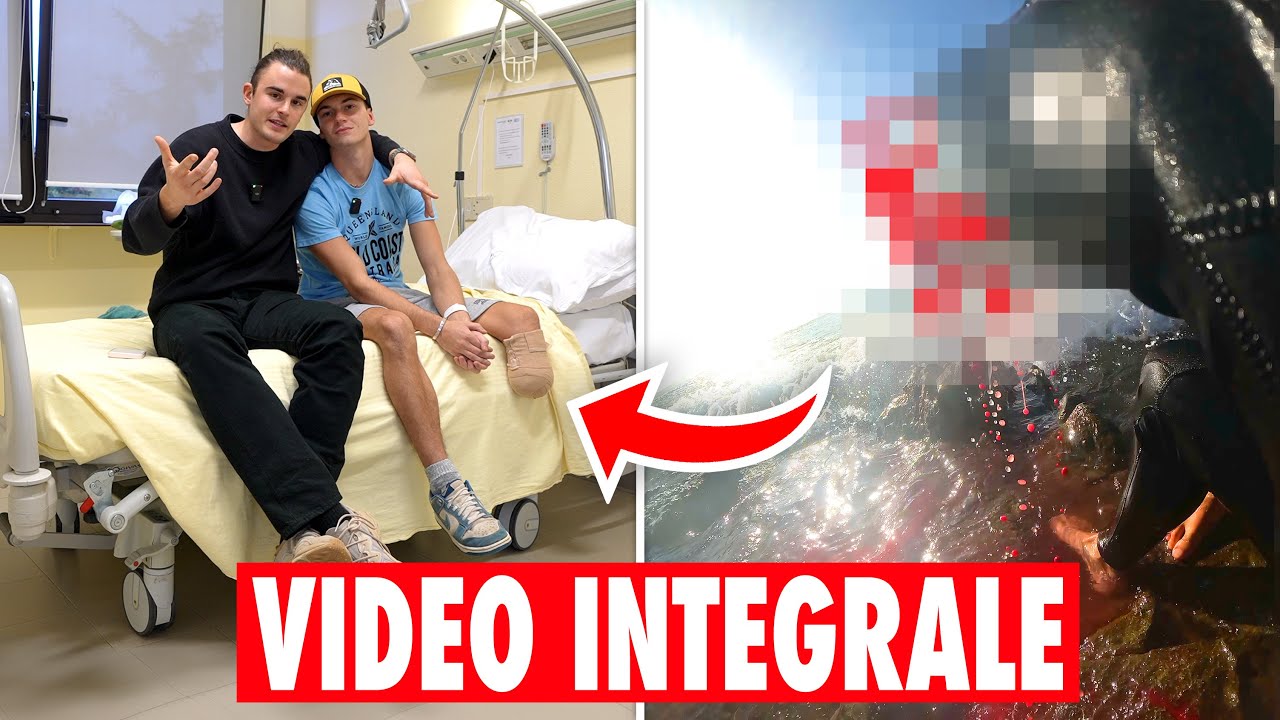 AMPUTATO DA UNO SQUALO, ACCUSATO DI TRUFFA!  [VIDEO INTEGRALE]