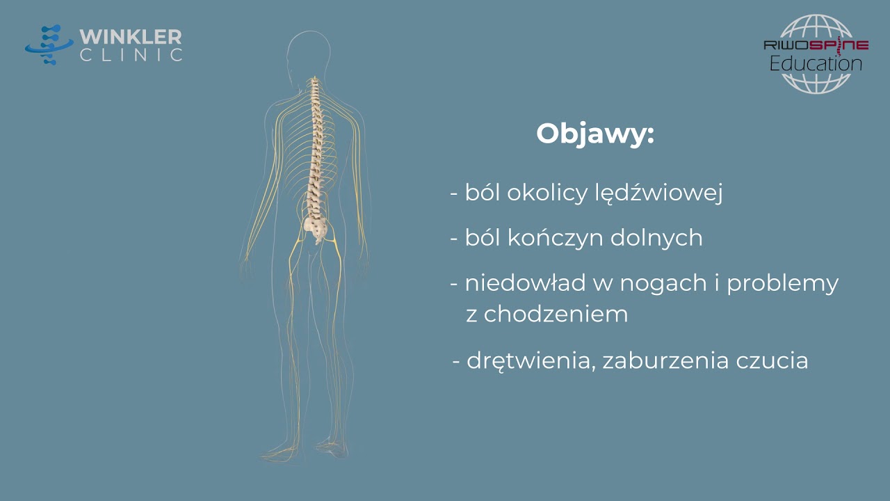 Endoskopowa dekompresja stenozy kanału kręgowego kręgosłupa lędźwiowego