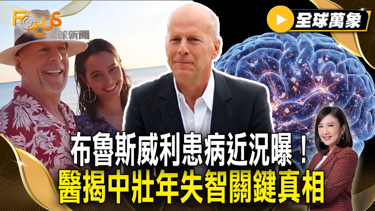 布魯斯威利患病近況曝！家人證實「已不自知」 醫揭中壯年失智關鍵真相【#全球萬象】#布魯斯威利 #失智 #中壯年