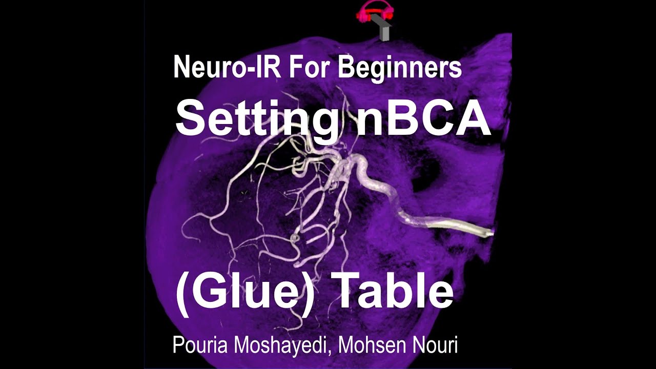 Preparing nBCA Glue Table for Neuro Endovascular Procedures