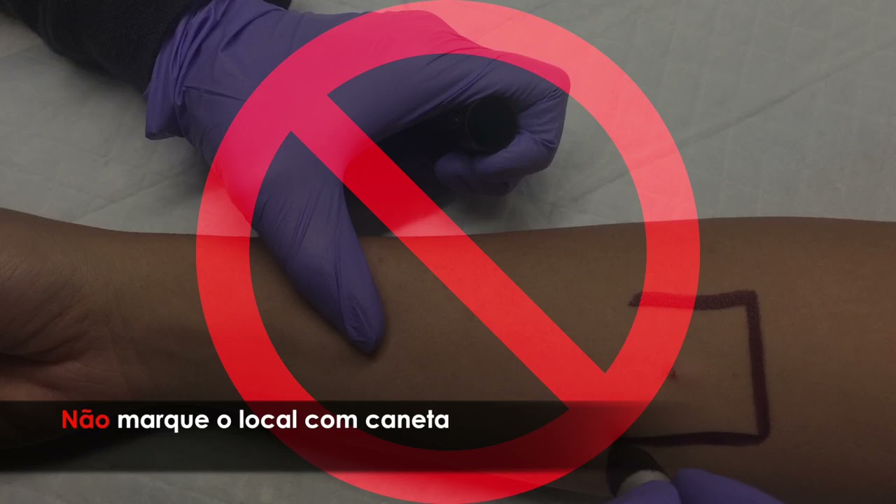 Capacitacao para a realizacao da prova tuberculinica (Portuguese)