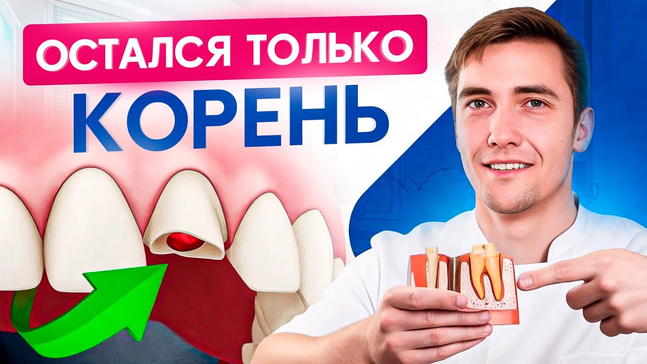 Как восстановить зуб, если от него остался только корень?