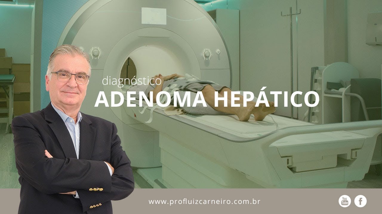 Adenoma hepático | Prof. Dr. Luiz Carneiro CRM 22.761