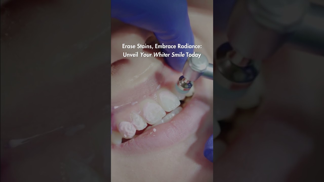 Erase Stains, Embrace Radiance: Unveil Your Whiter Smile Today.