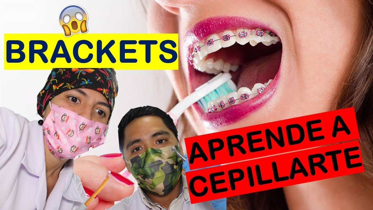 SI FUNCIONA: 🦷 Cómo lavar tus dientes usando BRACKETS😎 |  LA MEJOR LIMPIEZA PARA TUS DIENTES