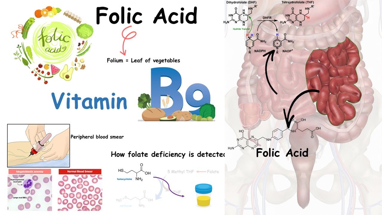 Folate ( Vitamin B9) and folate deficiency
