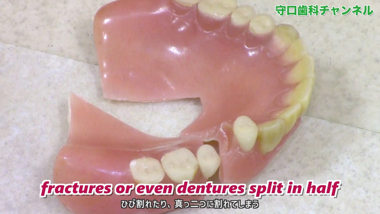 Denture Repair at Home | Dental Care at Home in Morioka, Japan_壊れた入れ歯も訪問診療で直せます！