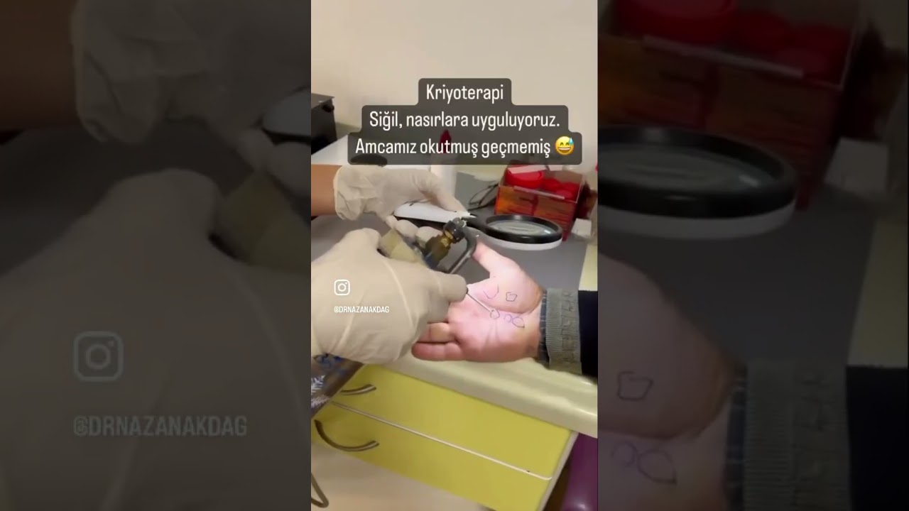 Dermatoloji polikliniğinde bir g&uuml;n - Kısa Vlog ✨ #dermatoloji #poliklinik #doktor