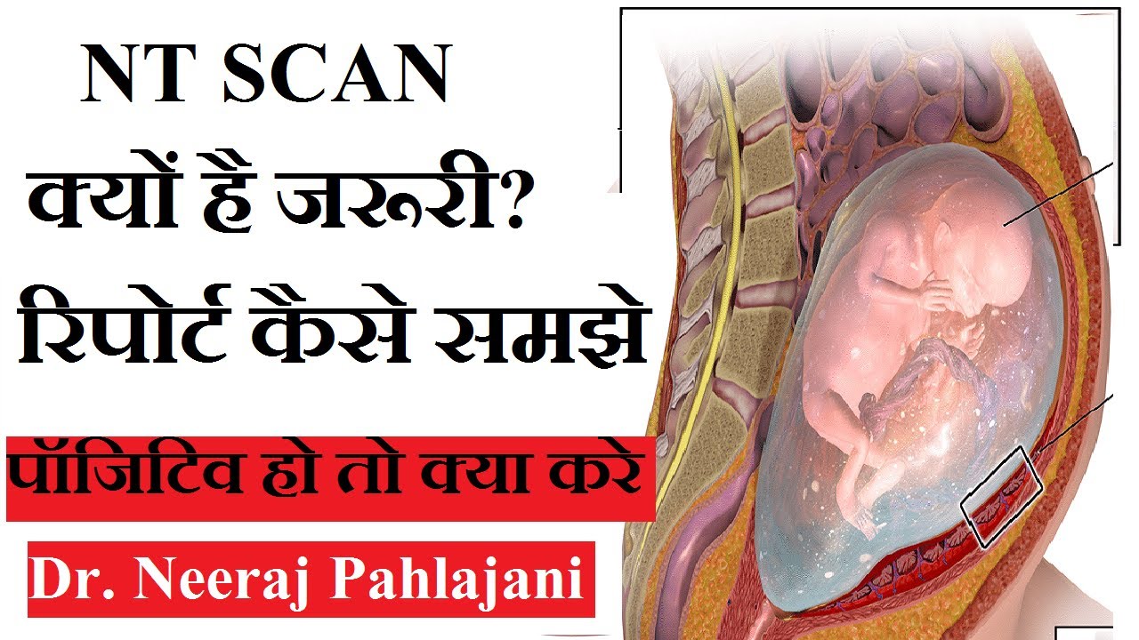 NT Scan in Hindi - प्रेगनेंसी के 13 हफ्ते का सबसे जरूरी टेस्ट NT Test