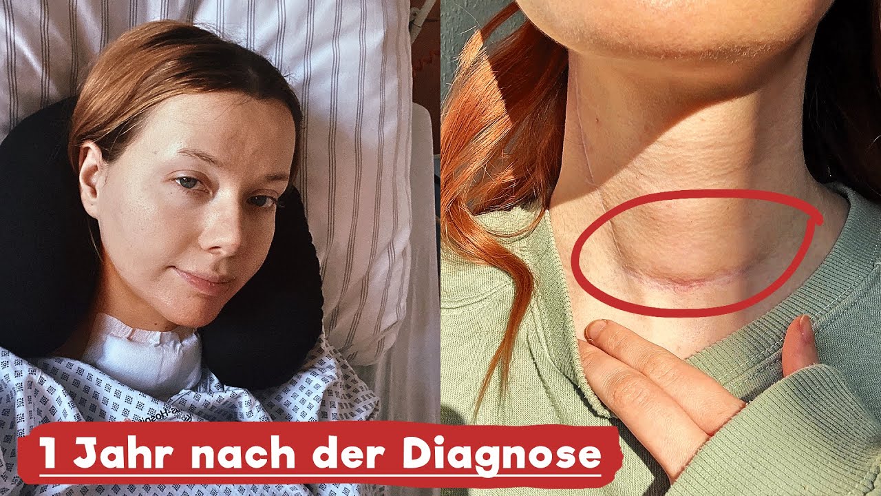 Mein (hoffentlich) letztes Krebs Update ❤️‍🩹 | 1 Jahr nach der Diagnose Schilddrüsenkrebs