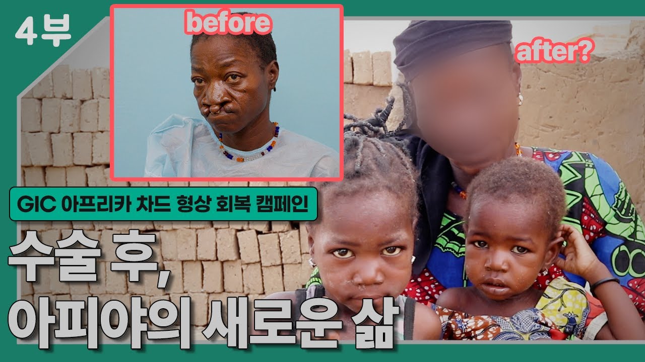 [GIC 후원 영상] 차드 의료봉사 형상회복 캠페인 - 아피야 (4부 최종회)