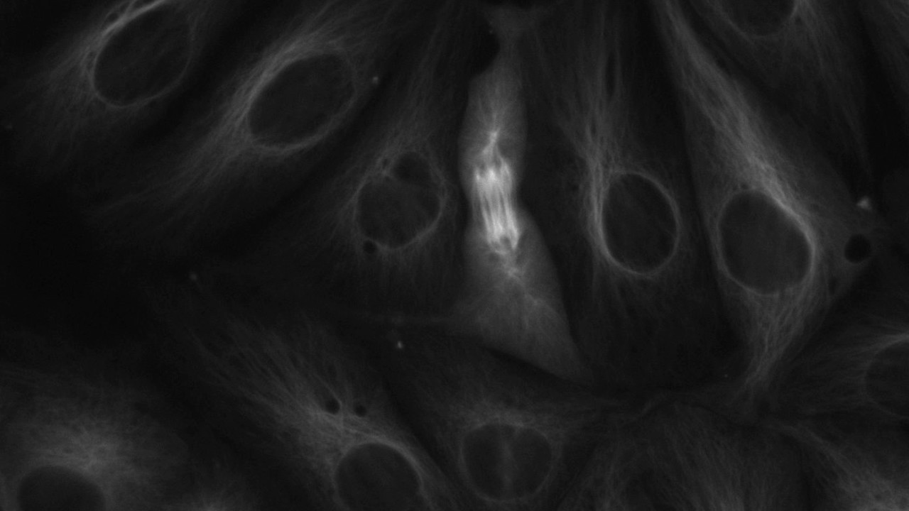 GFP LLC- Pk  cells from late anaphase to cytokinesis