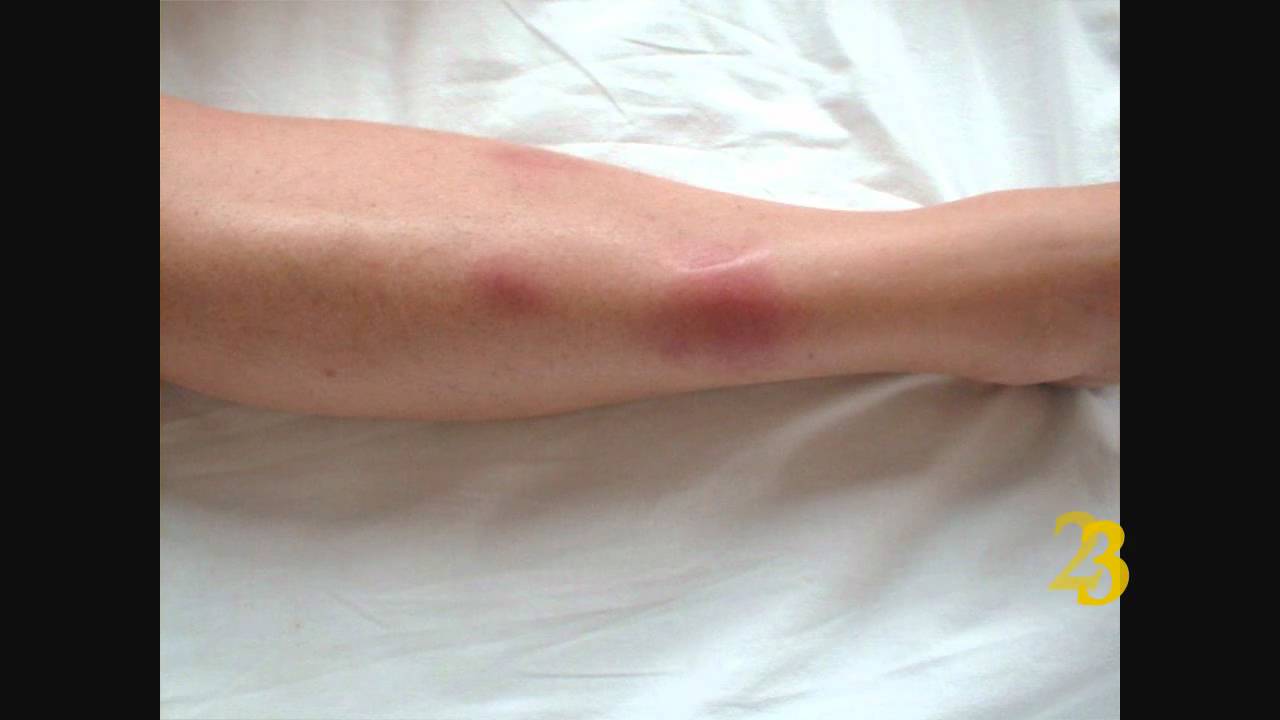 Rheumatology/Arthritis Image of the Month Quiz