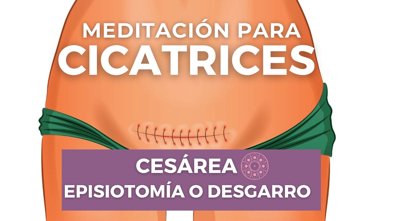 Meditación para SANAR TU CICATRIZ❤️‍🩹 después de #cesárea #episiotomía #desgarro | Luce tu Embarazo.