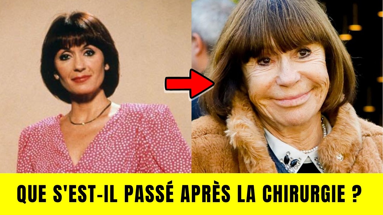 9 ACTRICES FRANÇAISES au VISAGE RADICALEMENT TRANSFORMÉ par la CHIRURGIE