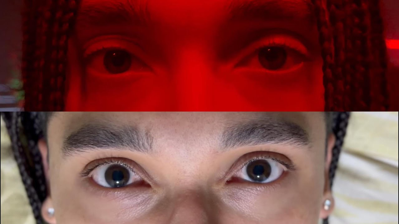 IWIS/DVNT