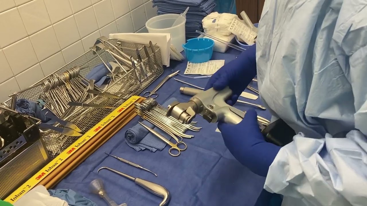 Above knee amputation