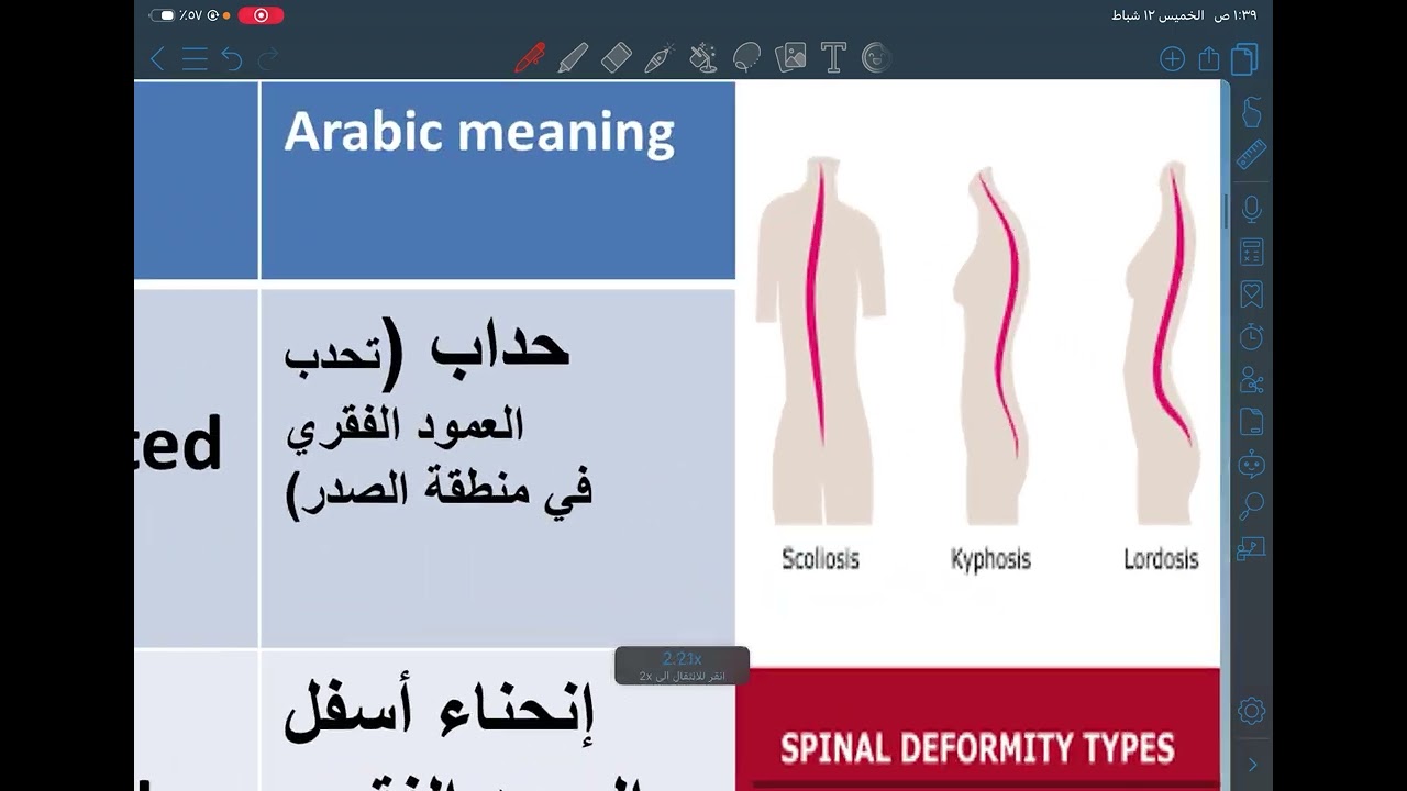 Alameed University| medical terminology “The skeletal system “| مرحلة اولى 