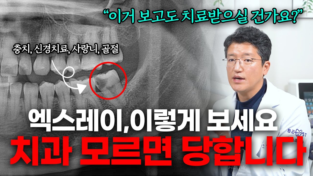 이것만 알아도 안 당합니다. 생각보다 쉬운 치과 엑스레이 보는 법