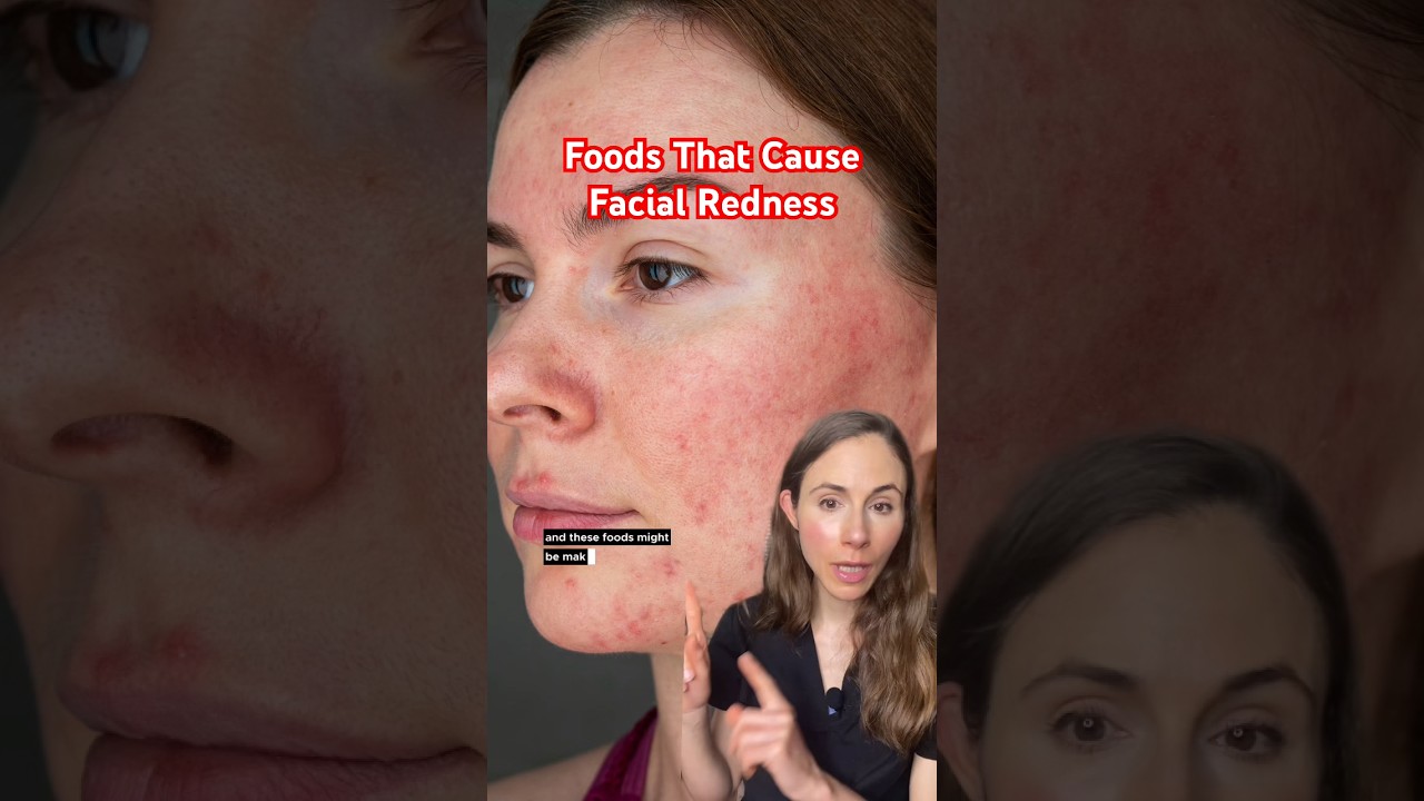 5 Foods That Make Your Face Red