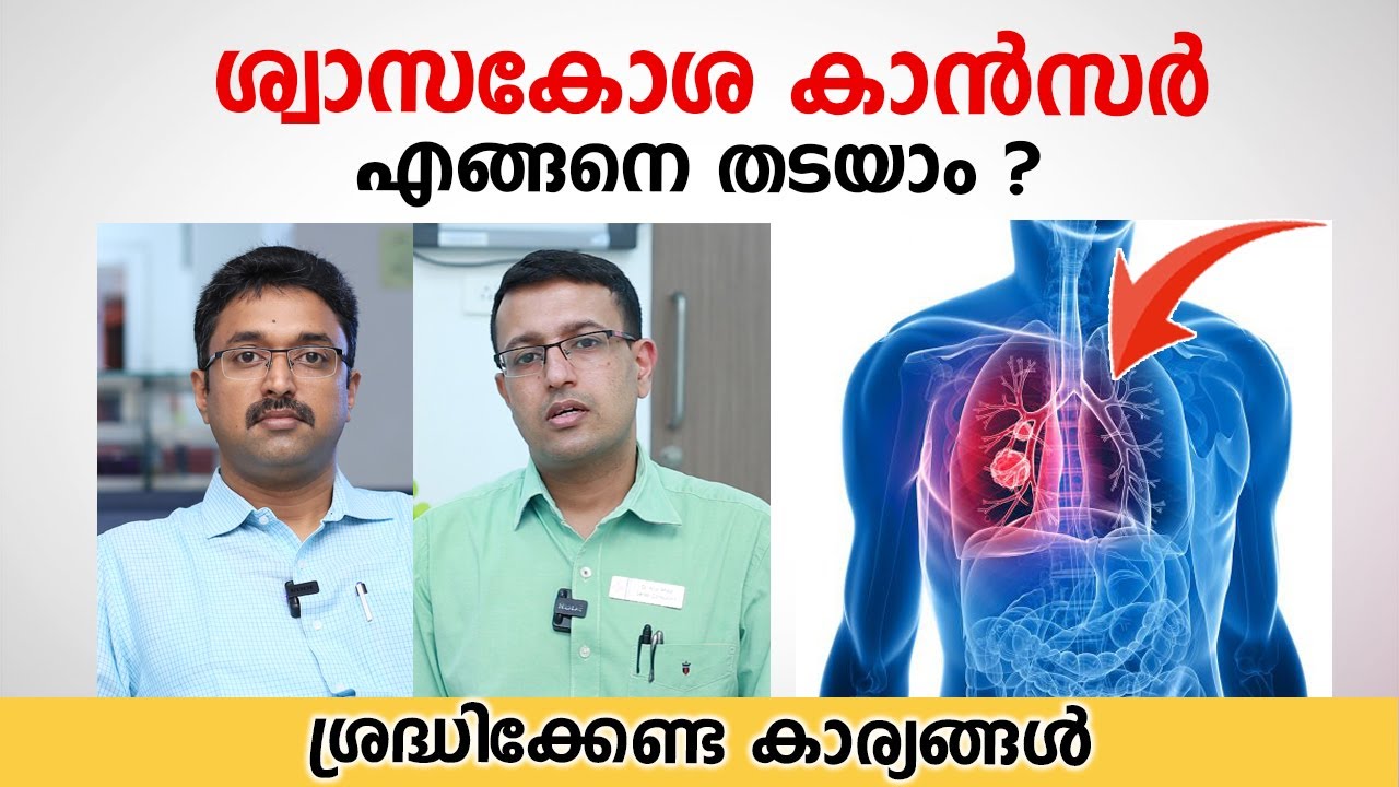 ശ്വാസകോശ കാൻസർ എങ്ങനെ തടയാം | Lung Cancer Treatment | Dr Sanju Cyriac