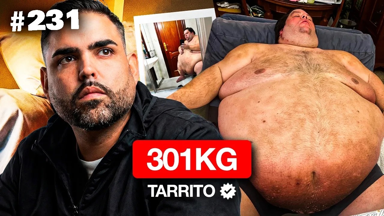 El INFIERNO de PESAR 300KG (así es su vida) 